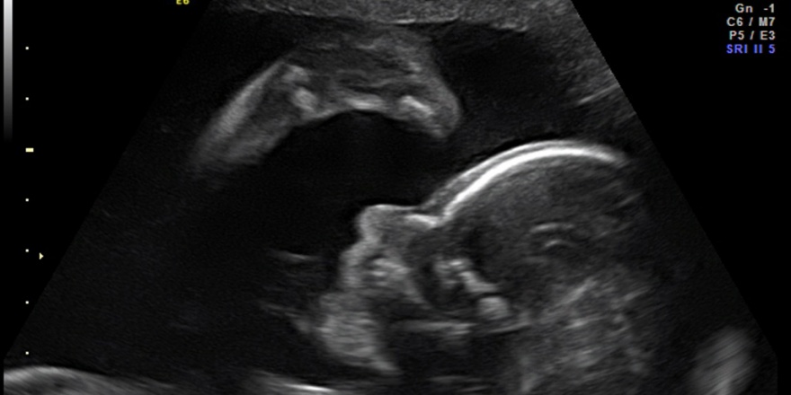 Schwangeren&shy;betreuung - Frauenarzt Augsburg Dr. Fischer & Kirschbaum