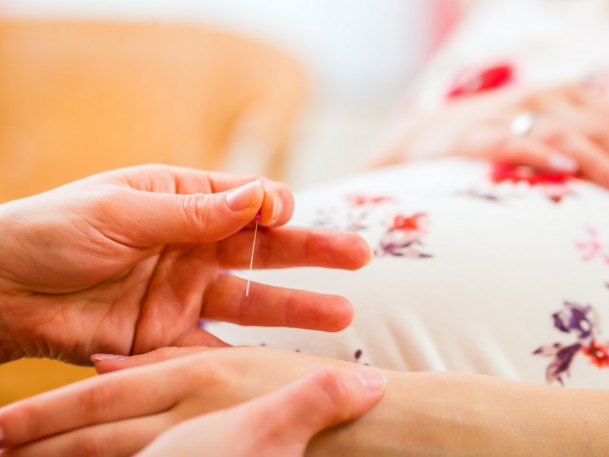 Akupunktur in der Schwanger­schaft - Frauenarzt Augsburg Dr. Fischer & Kirschbaum